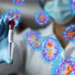 Caso en Italia revive atención sobre virus aviar con potencial pandémico