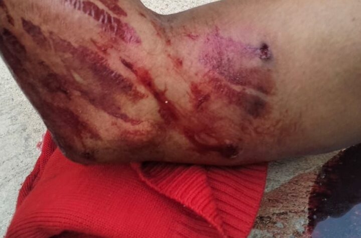 Ladrón resulta herido por disparos tras intentar asaltar un corralón