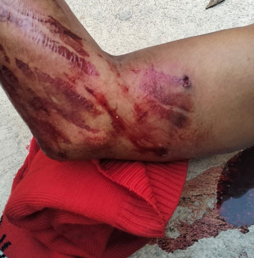 Ladrón resulta herido por disparos tras intentar asaltar un corralón