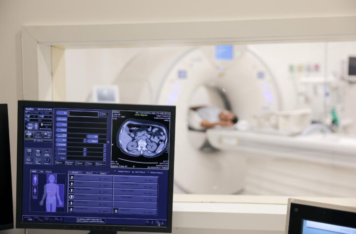  Nuevo Hospital O’Horán fortalece diagnósticos médicos con tomógrafo de última generación