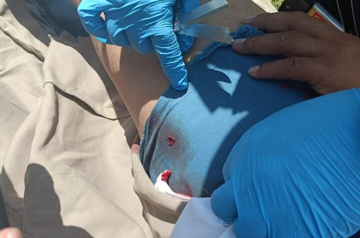 PERSONA LESIONADA POR BALINES EN LA CARRETERA TIZIMÍN-RÍO LAGARTOS