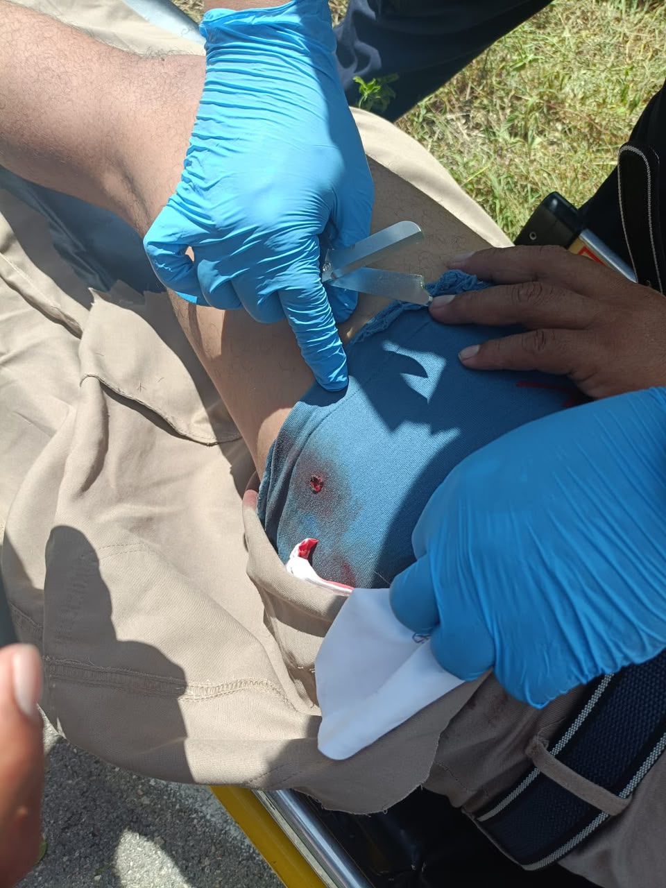 PERSONA LESIONADA POR BALINES EN LA CARRETERA TIZIMÍN-RÍO LAGARTOS